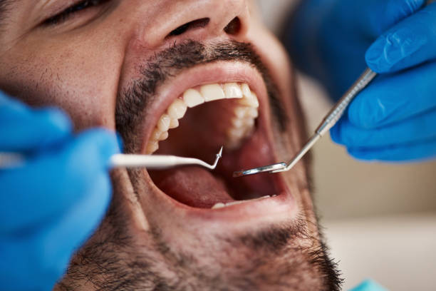 Best Emergency Dentist for Knocked-Out Tooth in Sutter Creek, CA
